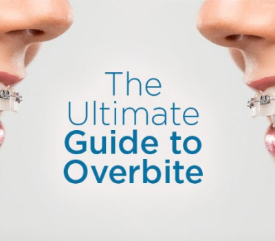 The difference between overjet and overbite